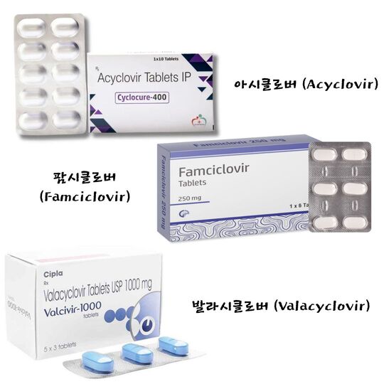 대상포진 치료, 항바이러스제 종류 - 아시클로버 (Acyclovir), 팜시클로버 (Famciclovir), 발라시클로버 (Valacyclovir)