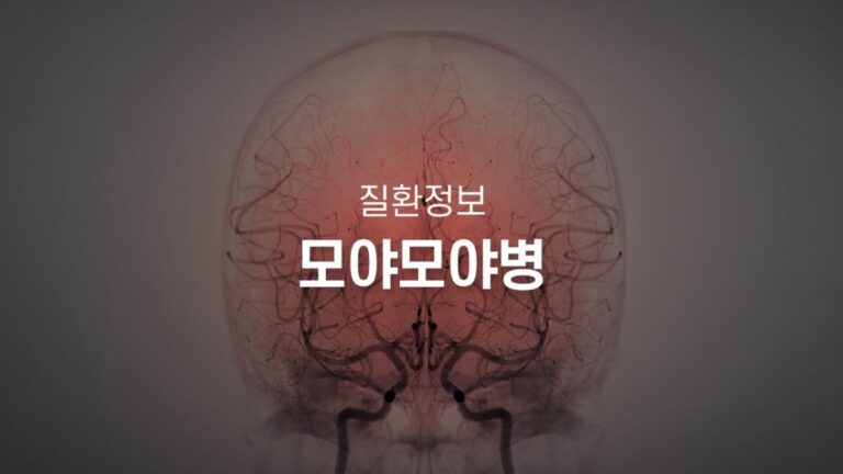 모야모야병 진단, 어떤 검사를 받게 될까? 병원에서 받는 뇌혈관 검사 7가지