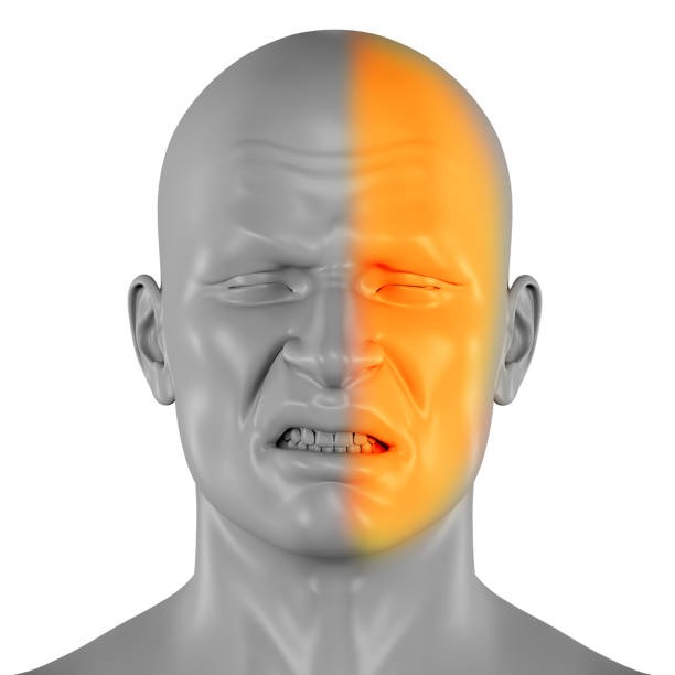 파킨슨병 표정 기능 저하