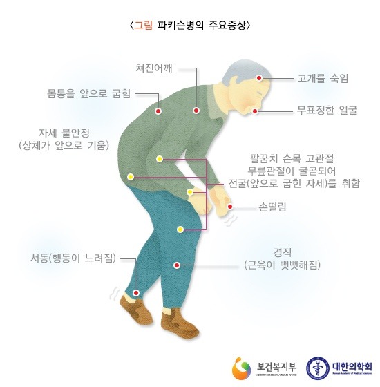 파킨슨병의 주요 증상 (출처=보건복지부, 대한의학회)