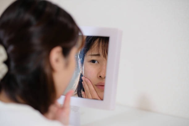 비립종 생기는 이유, 눈가에 오돌토돌 왜 자꾸 올라올까?