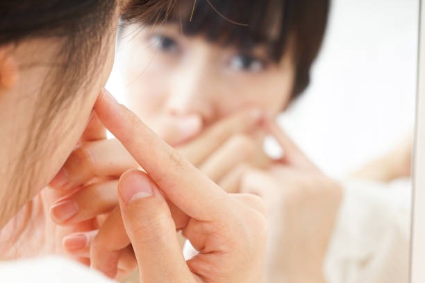 비립종 셀프 제거, 절대 하지 마세요! 위험한 이유와 안전한 방법